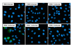 Anti-Dengue virus Envelope protein antibody [GT643] used in Immunocytochemistry/ Immunofluorescence (ICC/IF). GTX629117